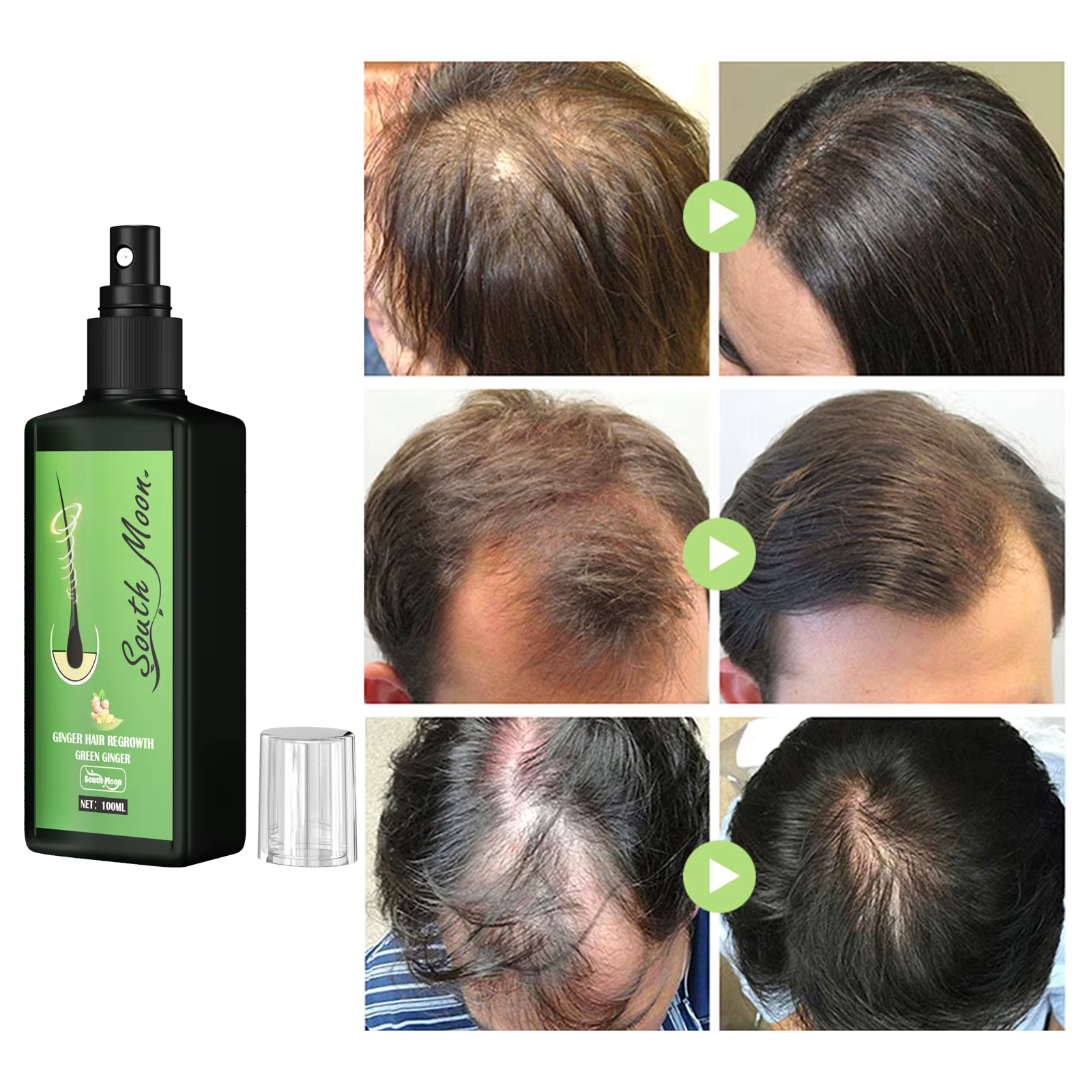 Sérum Capillaire Densifiant au Gingembre en Spray – Efficace, Nourrissant, Épaississant les Racines, Revitalisant le Cuir Chevelu, Anti-Chute, Massage du Cuir Chevelu
