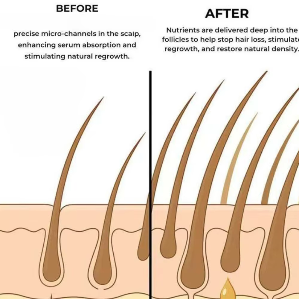 Sérum capillaire doux qui nourrit le cuir chevelu et s'occupe de l'adoucissement des cheveux. Soin quotidien