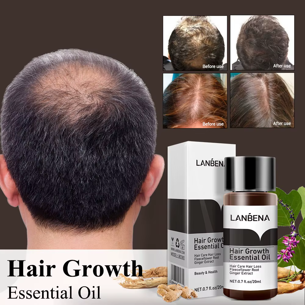 LANBENA huile essentielle nourrissante pour cheveux traitement Anti-perte