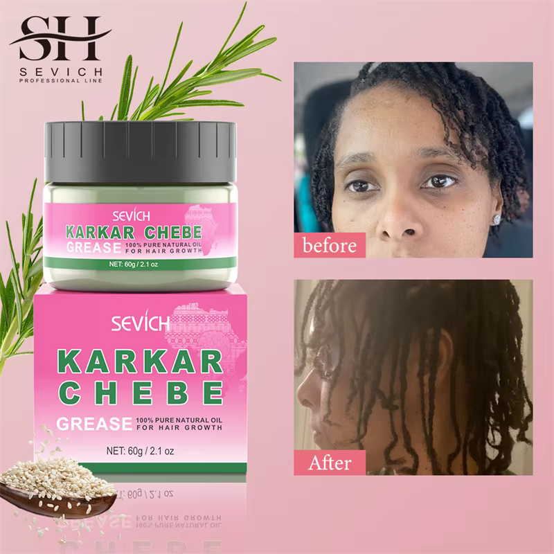 KARKAR – beurre capillaire pour la croissance des cheveux