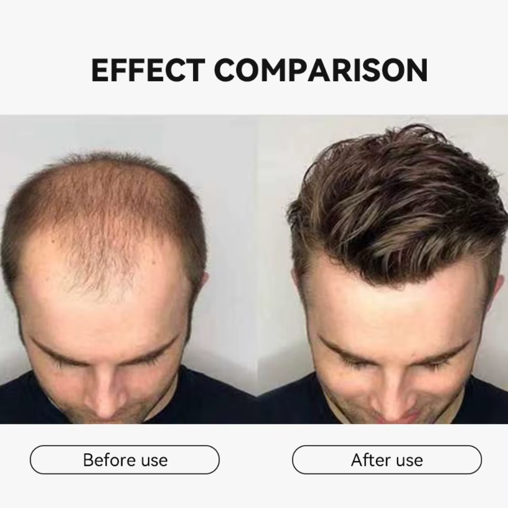 Sérum capillaire doux qui nourrit le cuir chevelu et s'occupe de l'adoucissement des cheveux. Soin quotidien