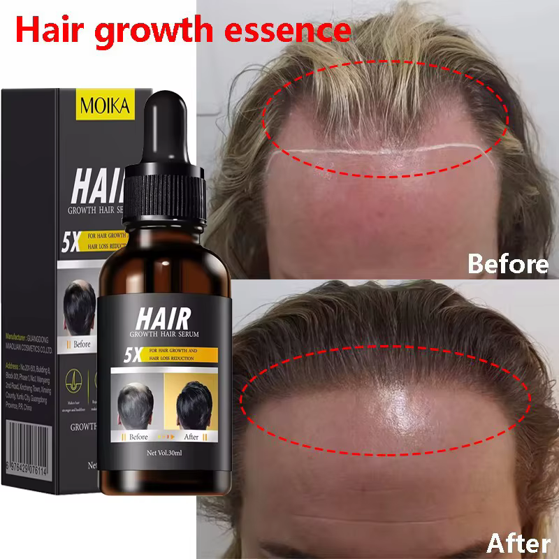 Sérum de croissance rapide des cheveux