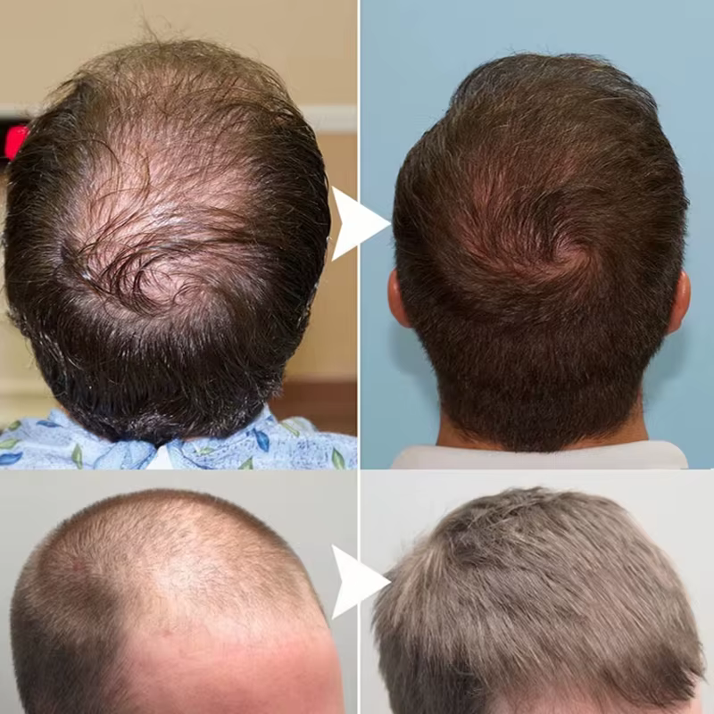 Sérum de croissance des cheveux au gingembre
