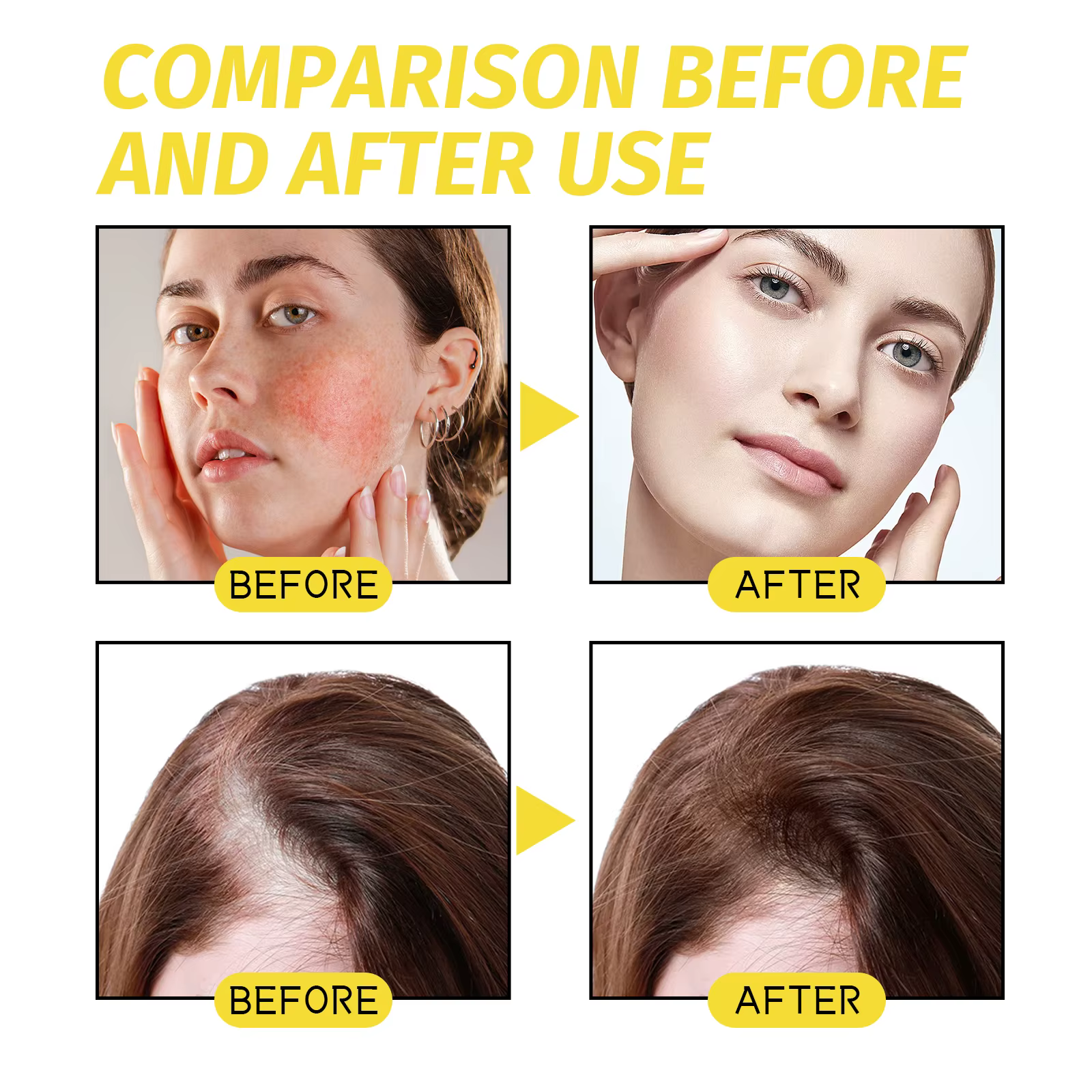 Huile essentielle pour la croissance des cheveux. Répare efficacement les symptômes de calvitie et de perte