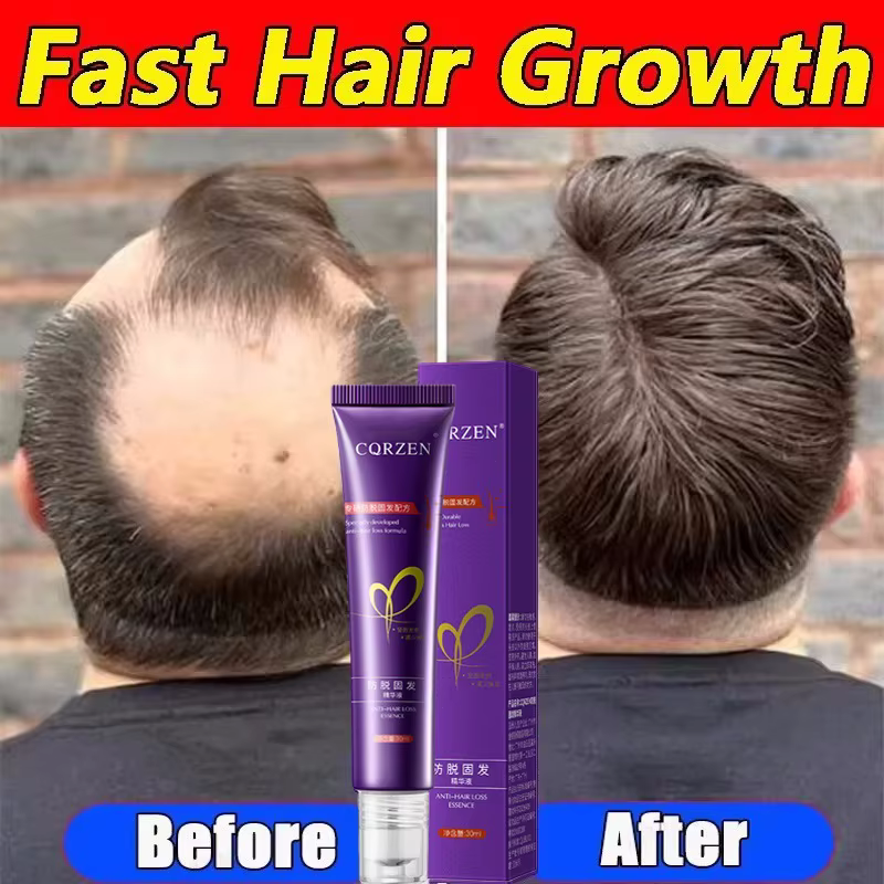 Sérum de croissance des cheveux 7 jours