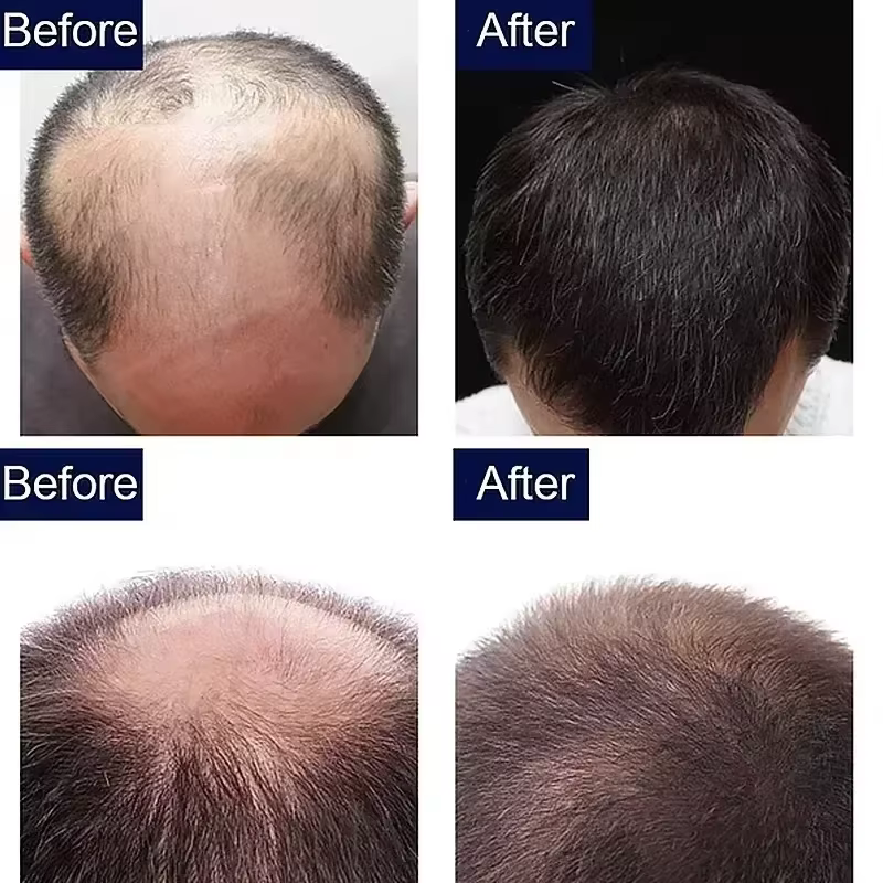 Sérum de croissance des cheveux