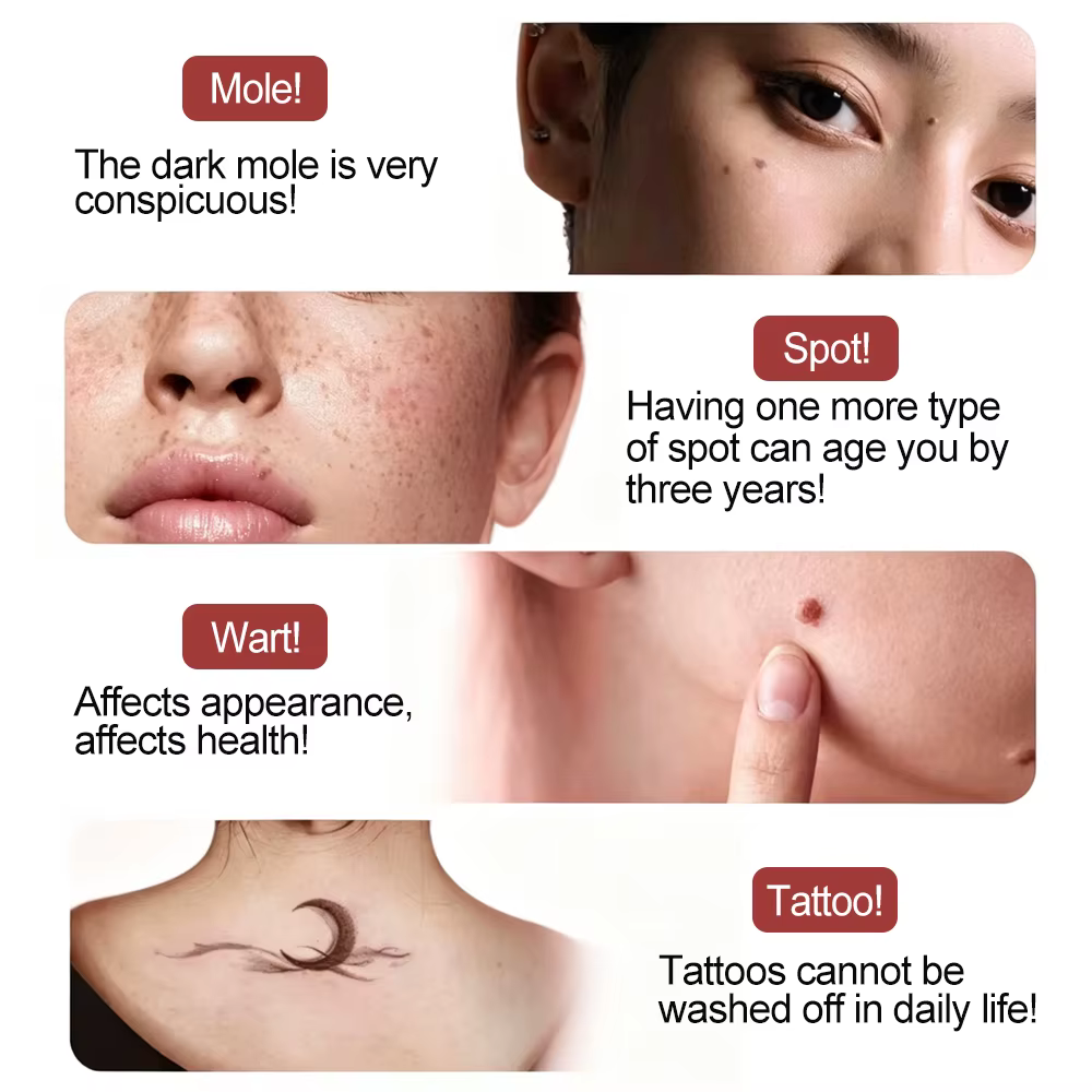 Stylo Plasma fibroblastique 9 vitesses, ascenseur de paupière, point noir électrique, élimination des taches de rousseur, Plasmapen, Machine sans fil pour Lifting de la peau du visage
