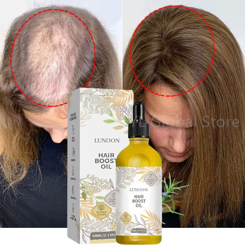 Sérum de croissance des cheveux à la rosemaine