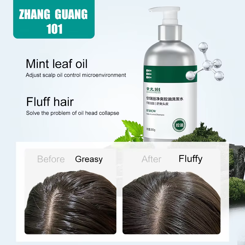 Zhang Guang 101 contrôle de l'huile apaisante cuir chevelu eau nettoyante équilibre