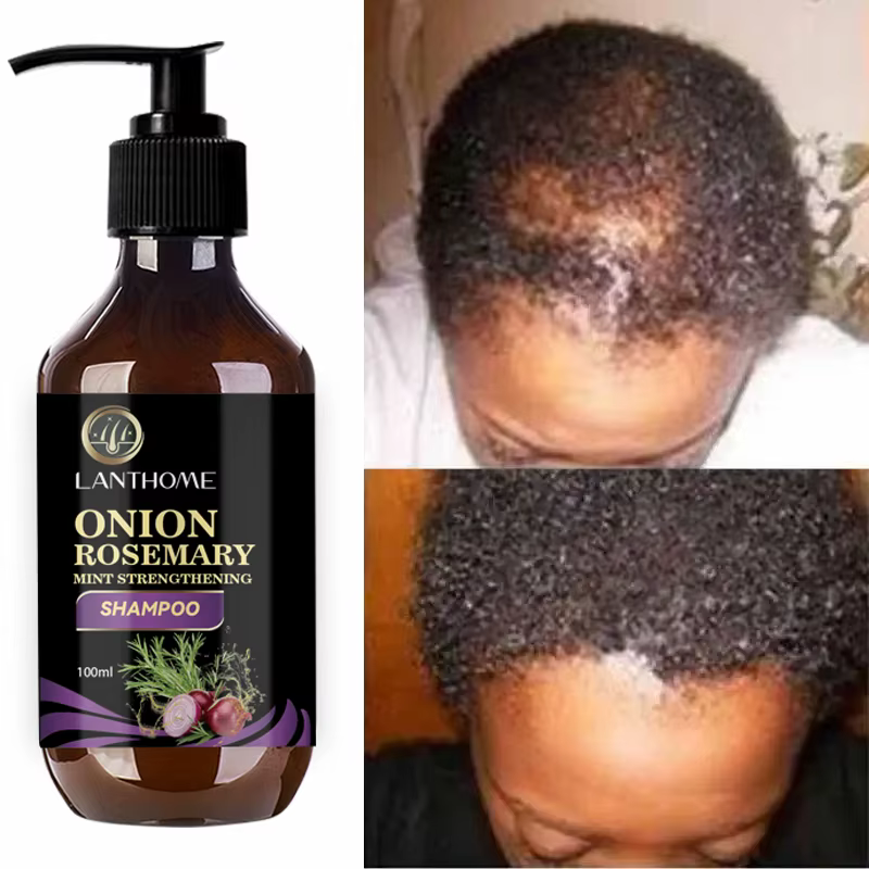 Shampoing cheveux pour une croissance rapide