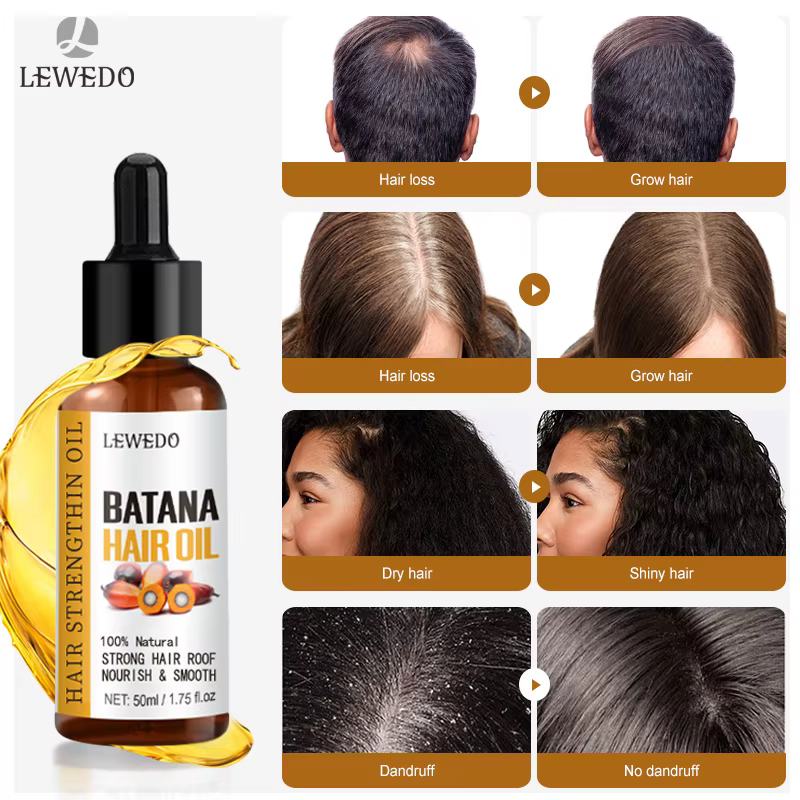 Lewedo Batana huile capillaire 100% sérum de croissance hydratant apaisant cuir chevelu régénération des cheveux Essence ensemble naturel hydrate nourrir