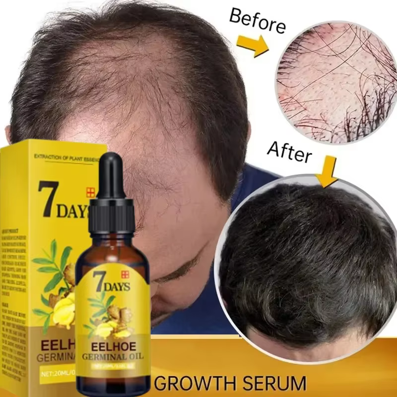 Huile de Croissance Rapide des Cheveux en 7 Jours pour Homme et Femme