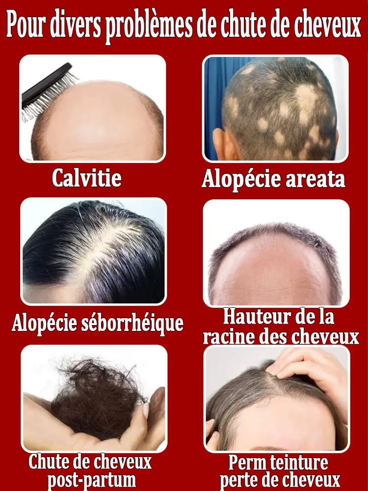 Faites-tu veux dire au revoir à la chute des cheveux? Nos produits peuvent pénétrer les follicules pileux et aider vos