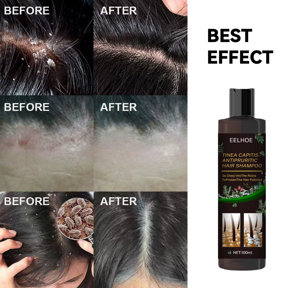 100ml Eelhoe shampooing Anti-démangeaisons