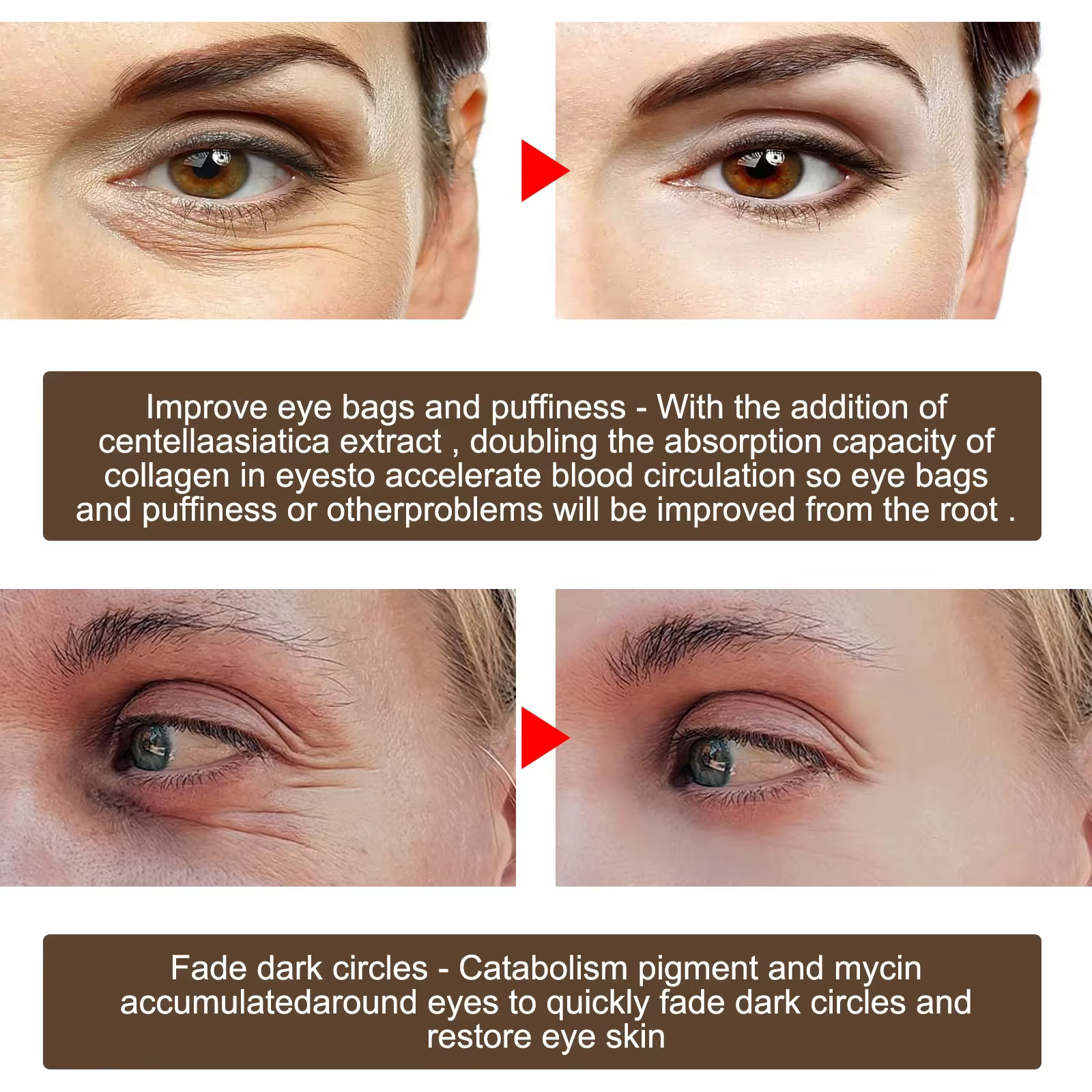 Crème pour les yeux à l'huile de jojoba, anti-rides, anti-âge, élimine les cernes, soin des yeux contre les poches et les gonflements, hydrate, raffermit la peau du contour des yeux
