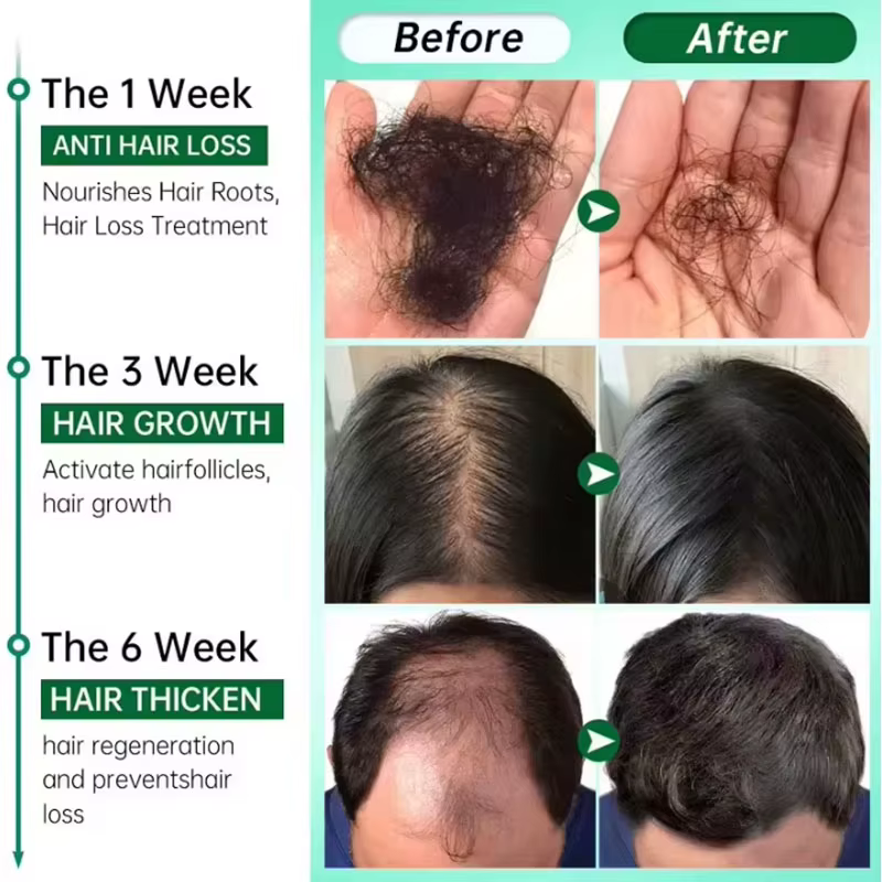 Sérum de croissance des cheveux au gingembre