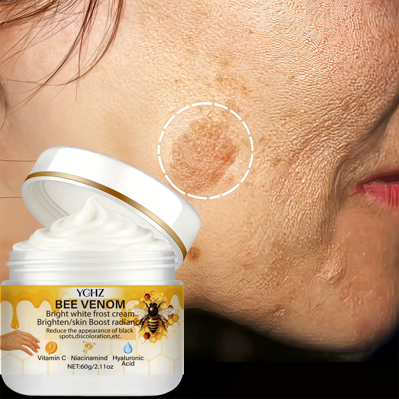 Crème éclaircissante au venin d'abeille, unifie le teint, élimine les taches brunes et le teint terne - Non grasse, convient aux hommes et aux femmes - Crème blanchissante et hydratante, pour usage de