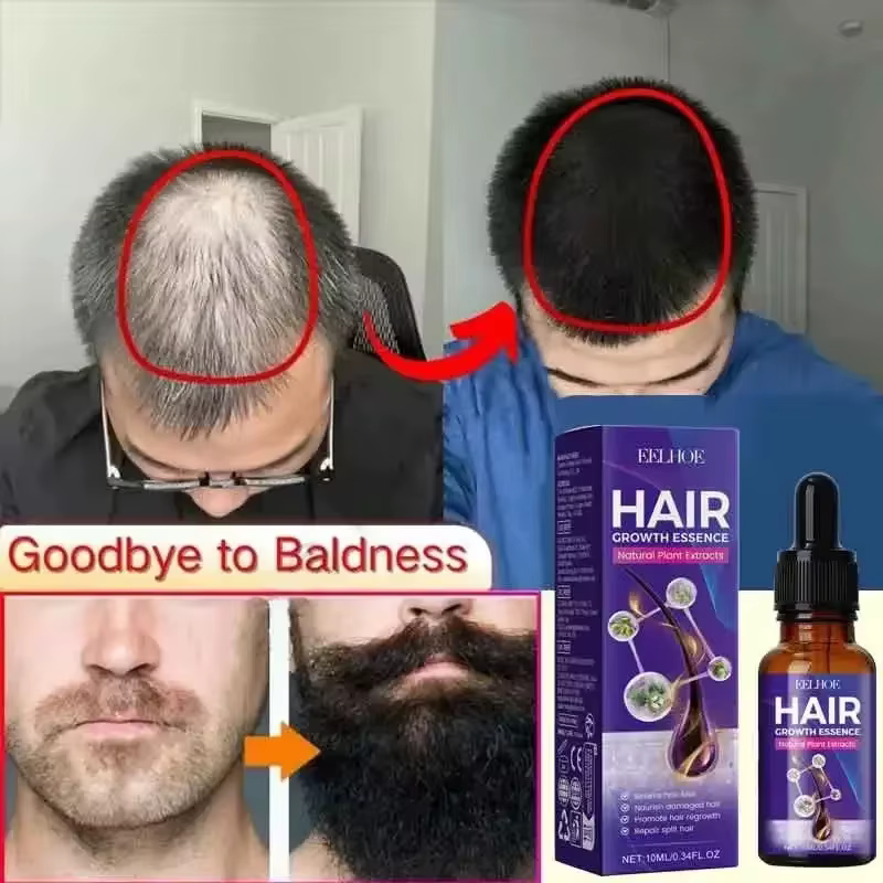 La croissance des cheveux
