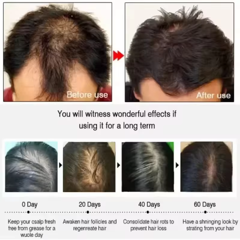 Crème de croissance des cheveux 7 jours