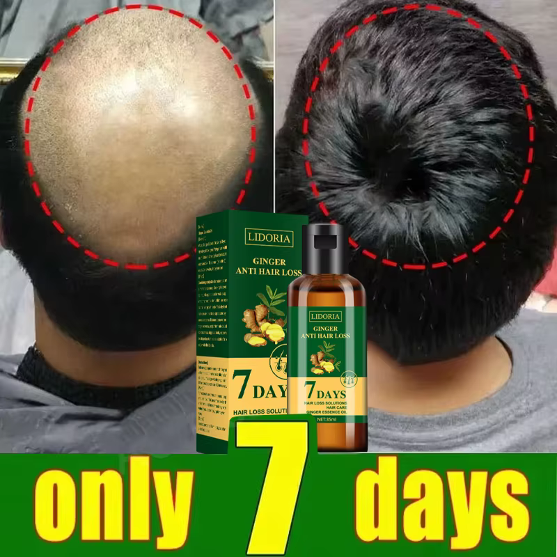 Sérum de croissance des cheveux pour hommes et femmes