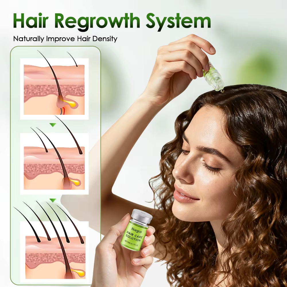 Huile de croissance des cheveux au gingembre pour hommes et femmes