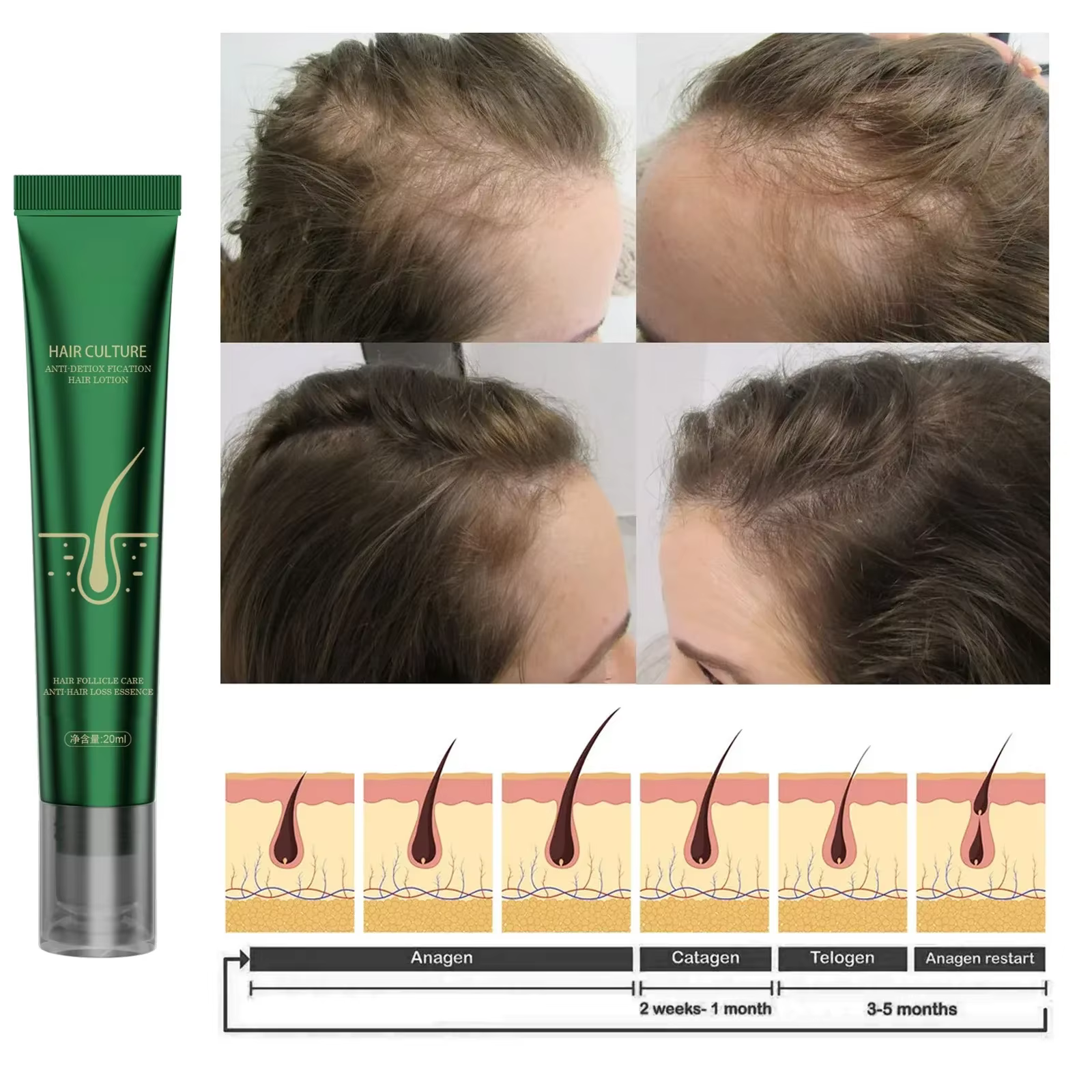 Huile essentielle de soin capillaire au gingembre naturel