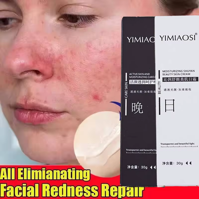 Crème réparatrice des rougeurs du visage coréenne, lotion hydratante et apaisante pour peaux sensibles, rosacée, hydratant jour et nuit pour améliorer la sécheresse