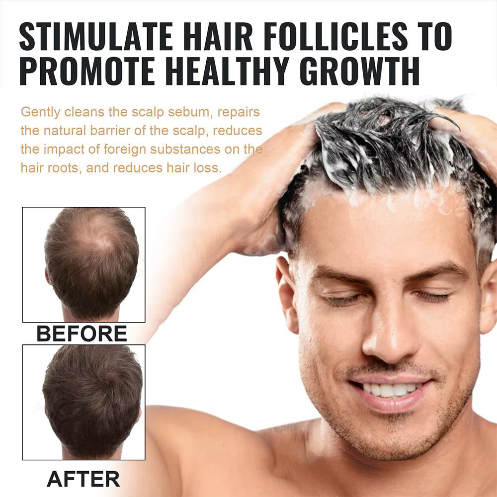 Eelhoe shampooing activateur de racines naturelles Anti-chute de cheveux soin