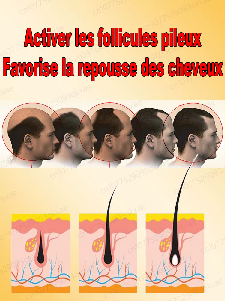 Faites-tu veux dire au revoir à la chute des cheveux? Nos produits peuvent pénétrer les follicules pileux et aider vos