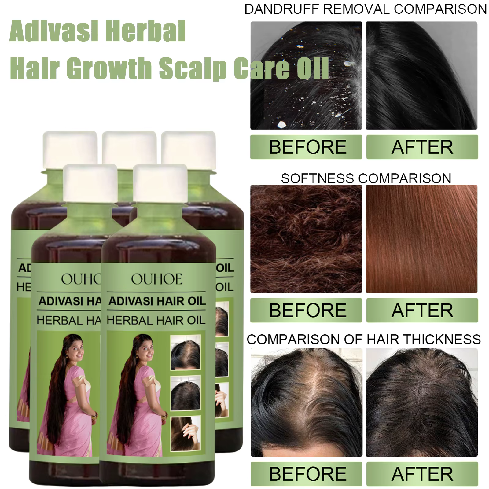100ml huile de croissance des cheveux inde Adivasi soins capillaires à base de plantes réparation au romarin hydrater endommagé hydrater le cuir chevelu réduire les pellicules