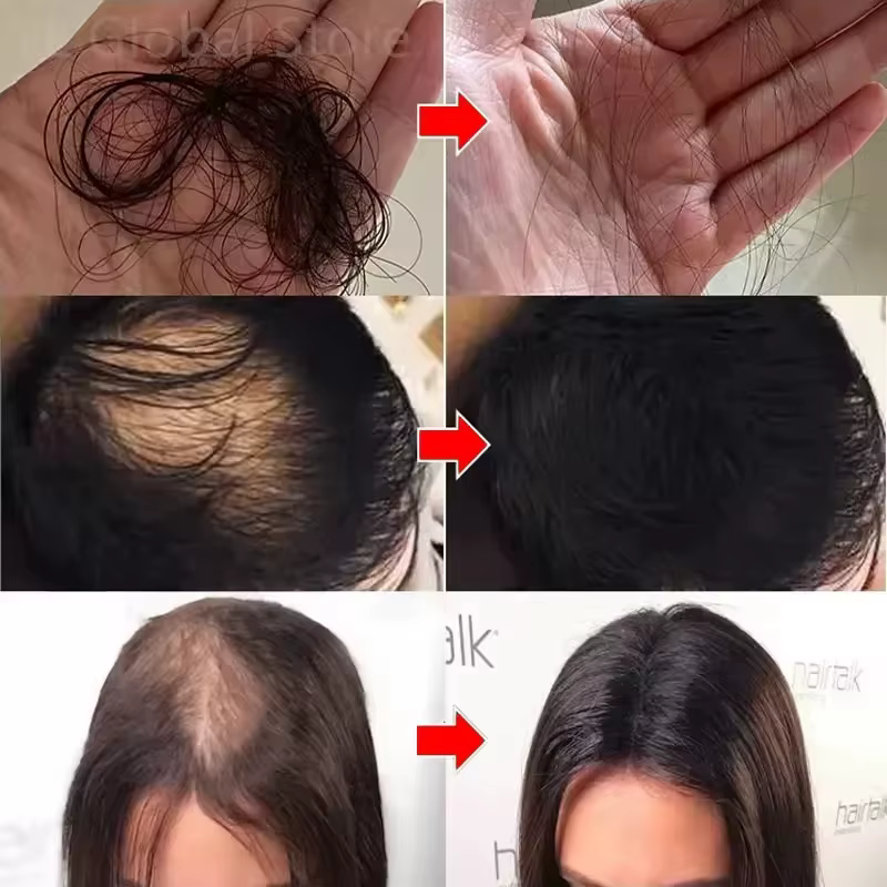 Crème de croissance des cheveux 7 jours