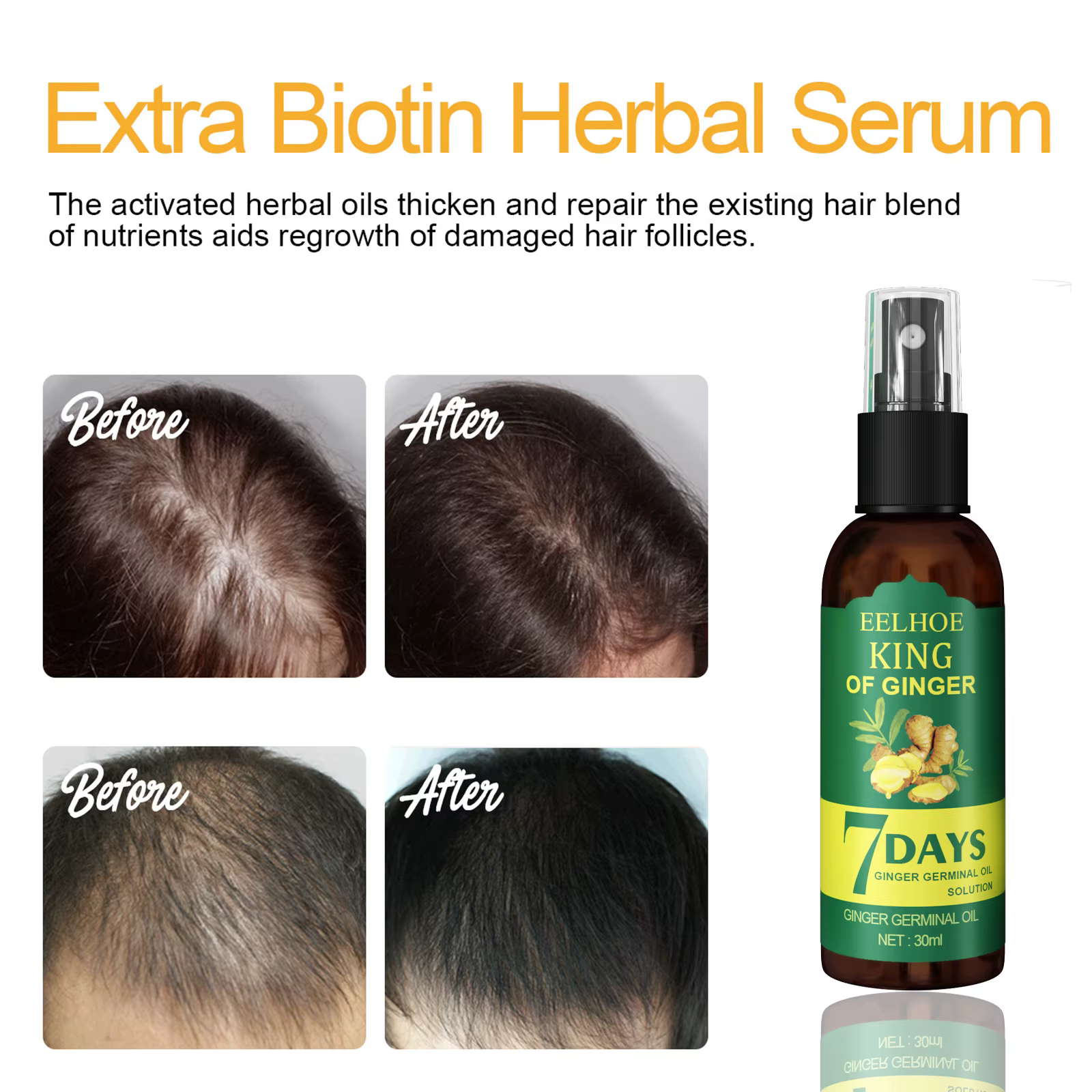 Sérum Booster capillaire à l'huile de gingembre