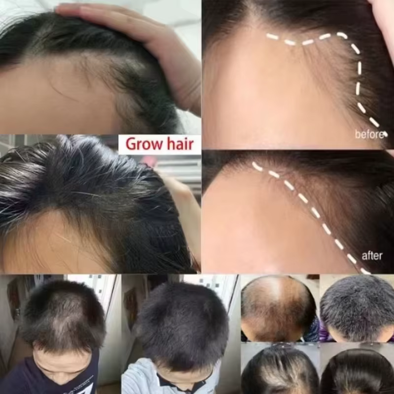 Sérum de croissance des cheveux au gingembre