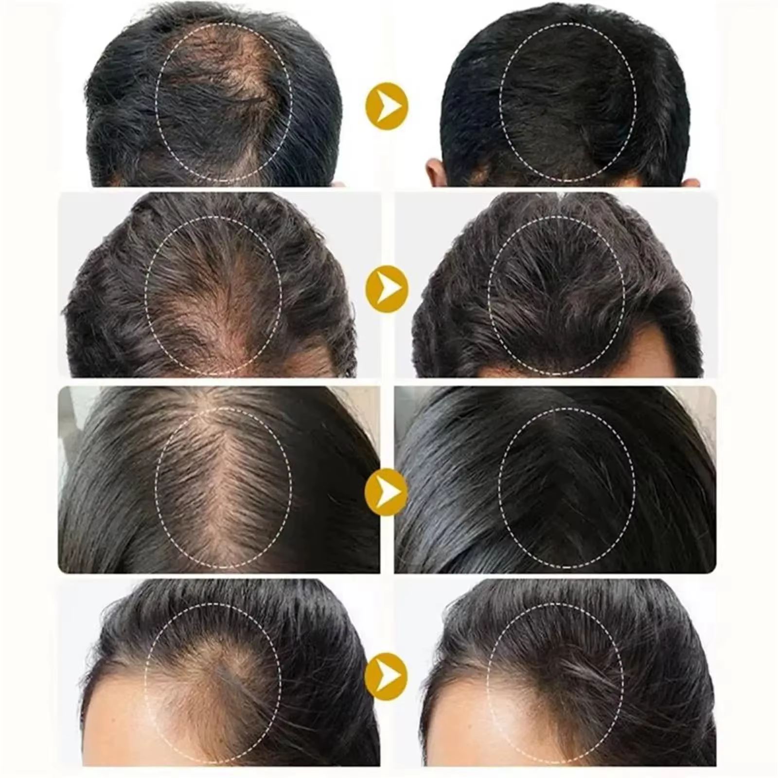 Sérum de croissance des cheveux