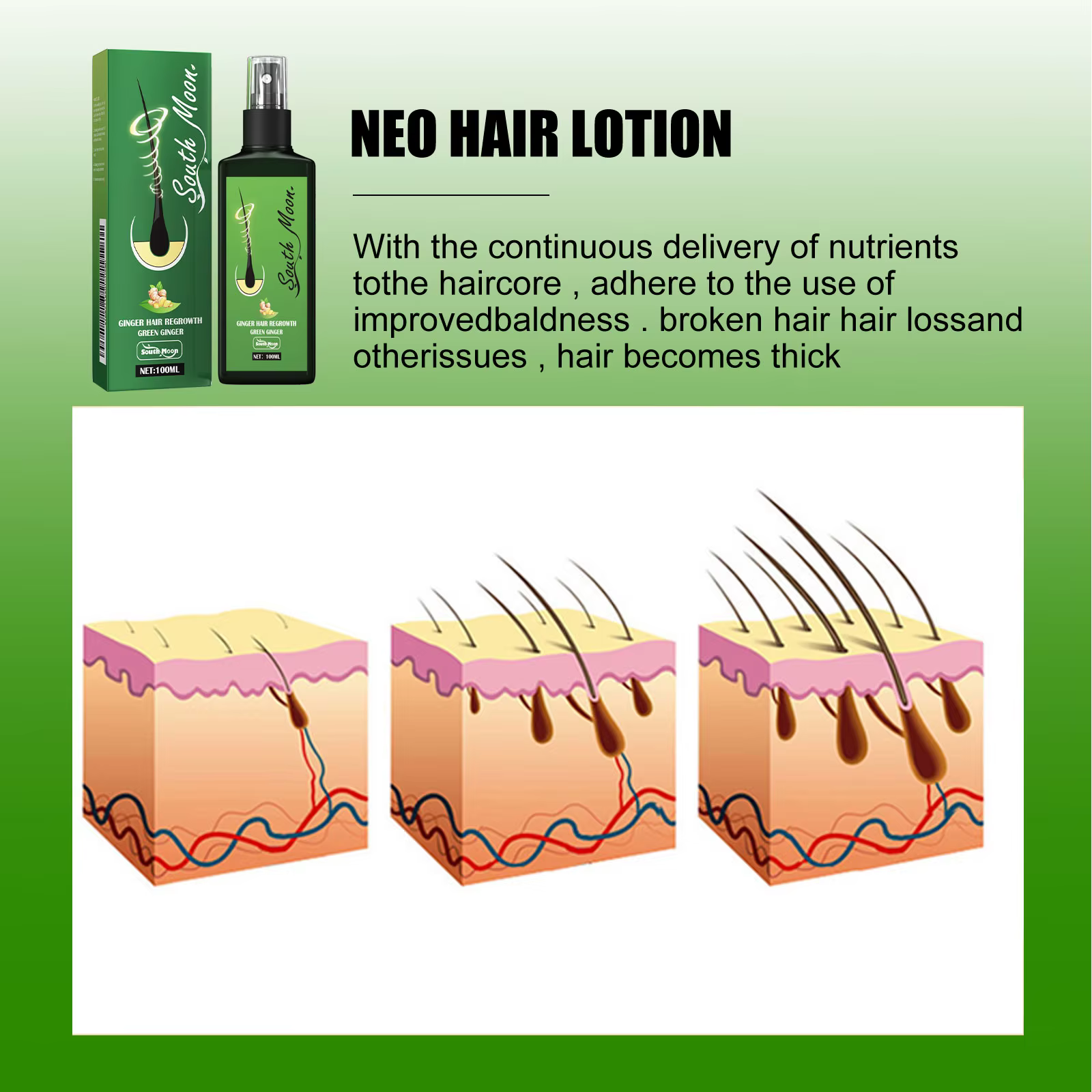 Sérum Capillaire Densifiant au Gingembre en Spray – Efficace, Nourrissant, Épaississant les Racines, Revitalisant le Cuir Chevelu, Anti-Chute, Massage du Cuir Chevelu
