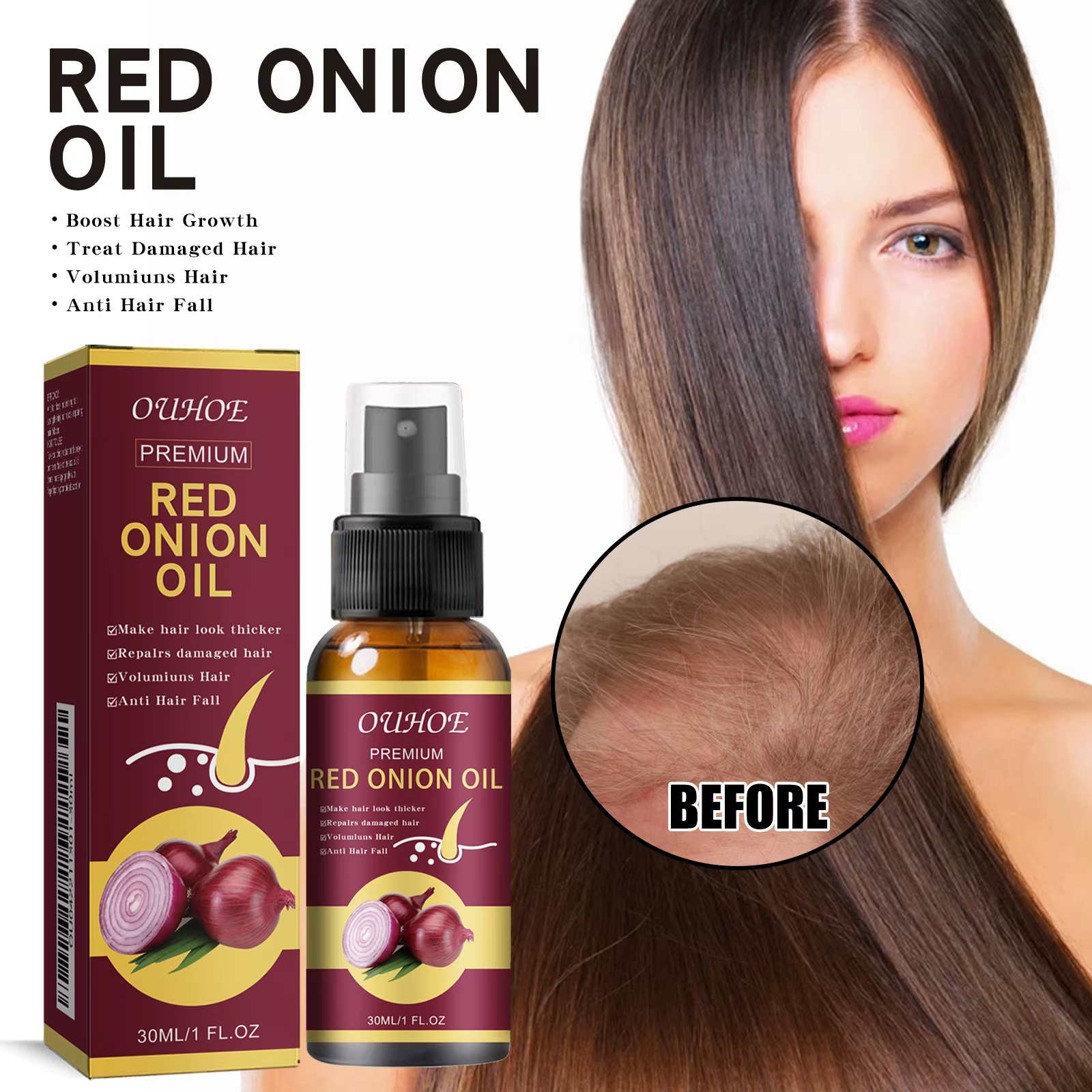 Huile essentielle pour la croissance des cheveux à l'oignon rouge