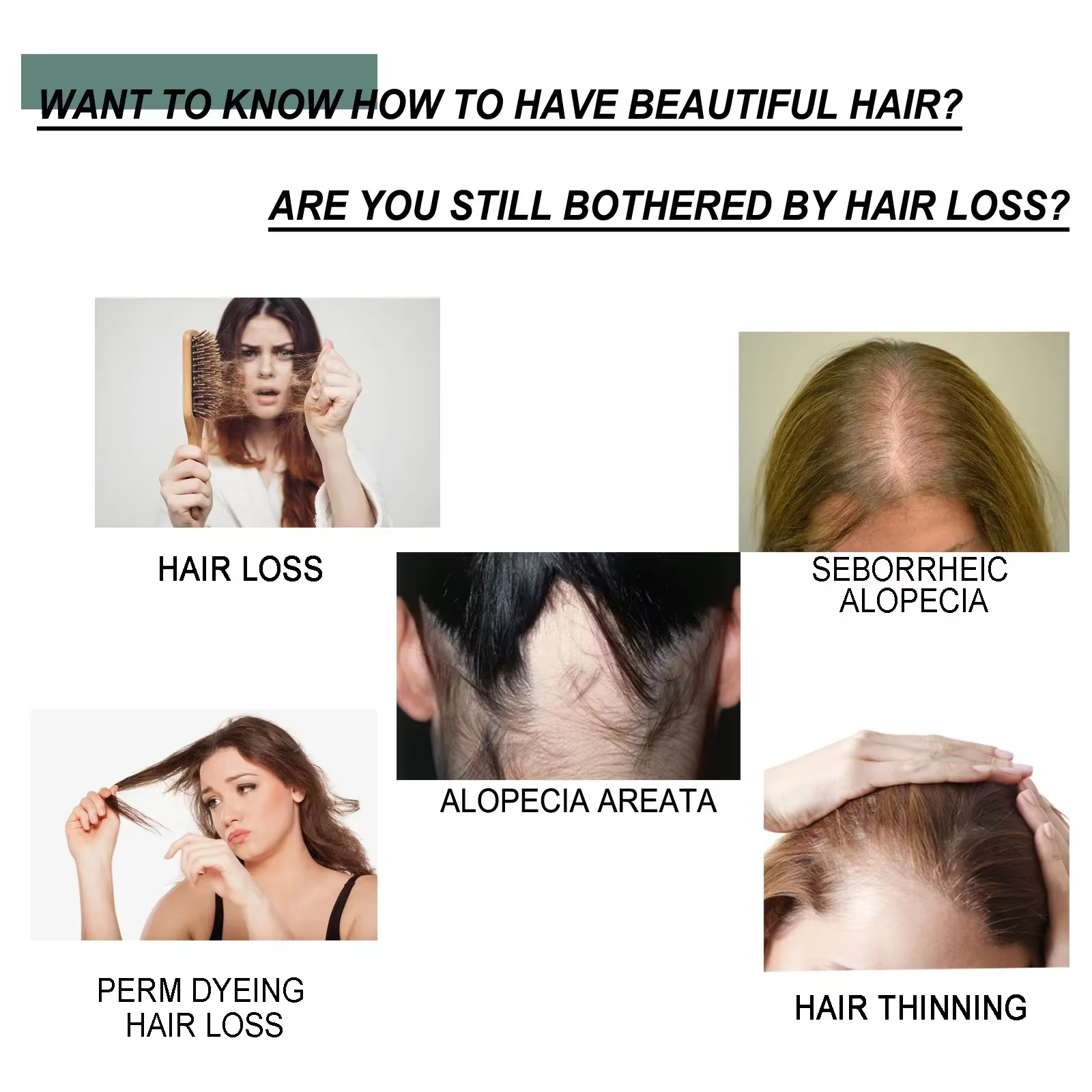 OUHOE sérum de croissance des cheveux réparation amincissement sec endommagé Massage cuir chevelu follicule racine dure