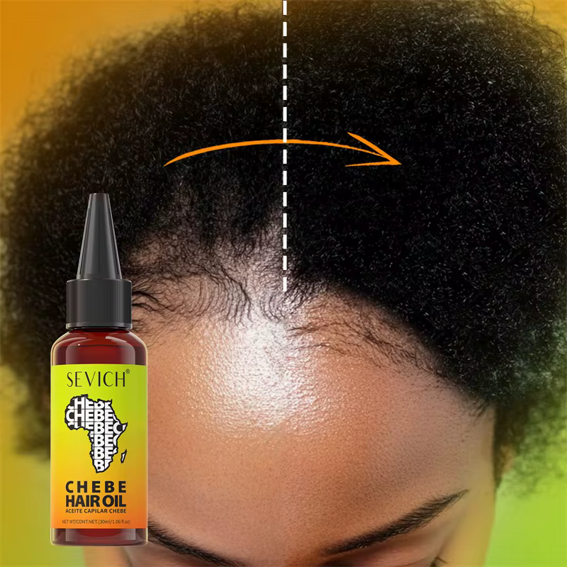Huile de croissance rapide des cheveux Chebe
