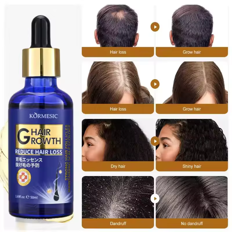 Sérum de croissance des cheveux