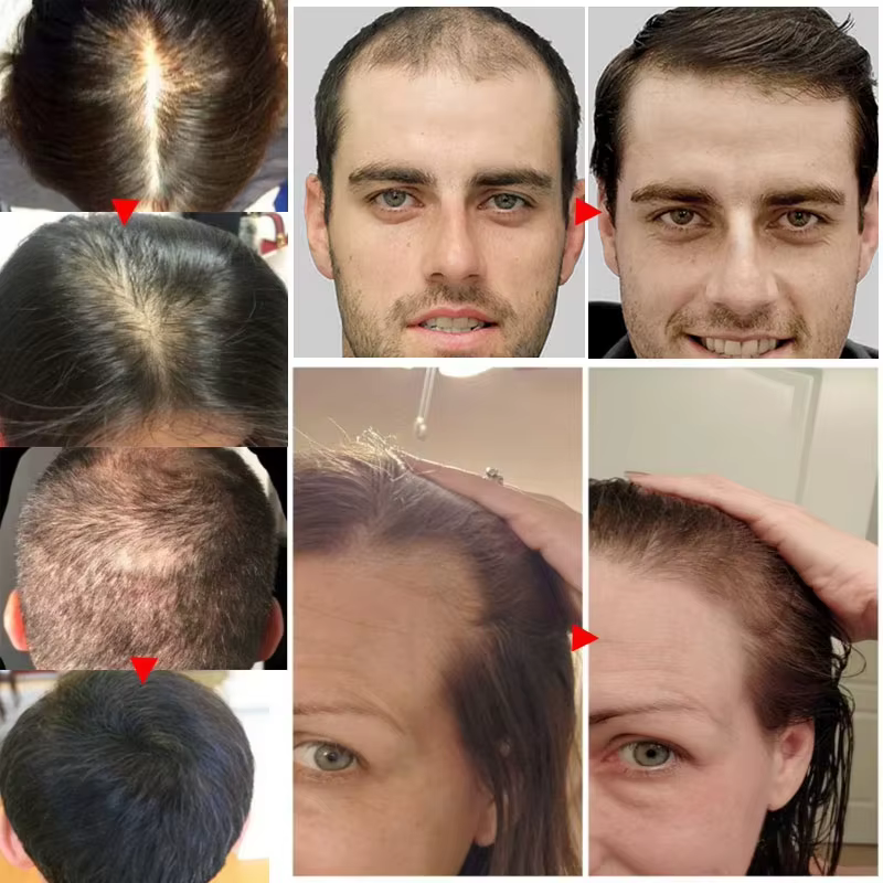 Sérum de croissance rapide des cheveux