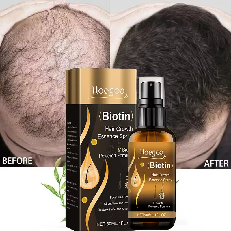 Spray de croissance rapide des cheveux à la biotine