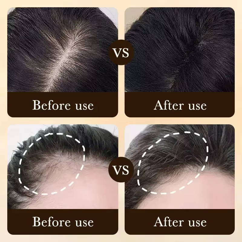 Traitement Essentiel de Repousse et de Croissance des Cheveux