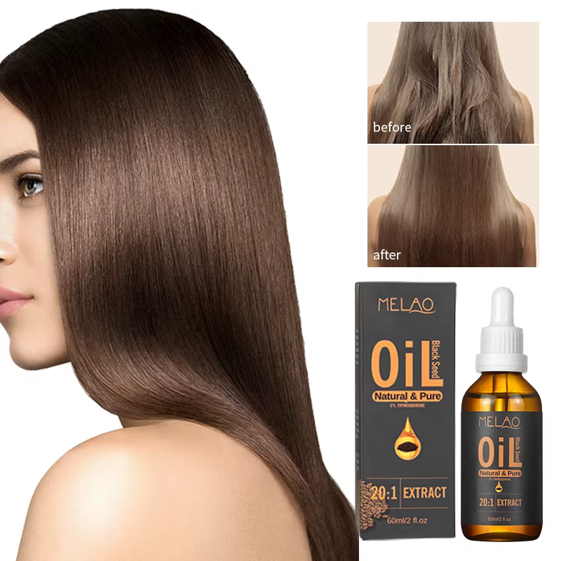 Huile de graines de cumin noir turc