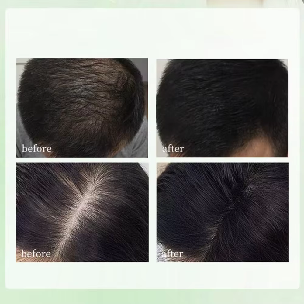 Shampoing à base de plantes naturelles