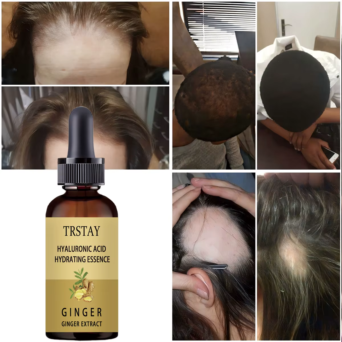 Sérum de croissance des cheveux