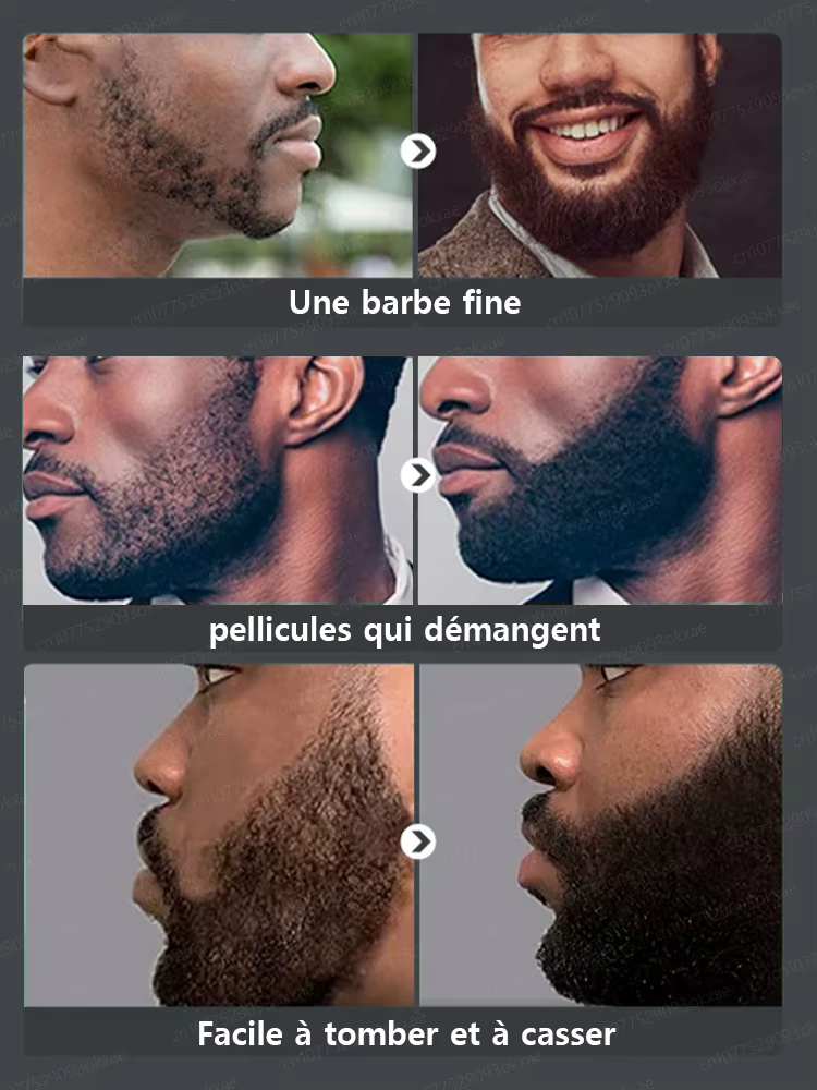 Essence de croissance de la barbe. Elle aide votre