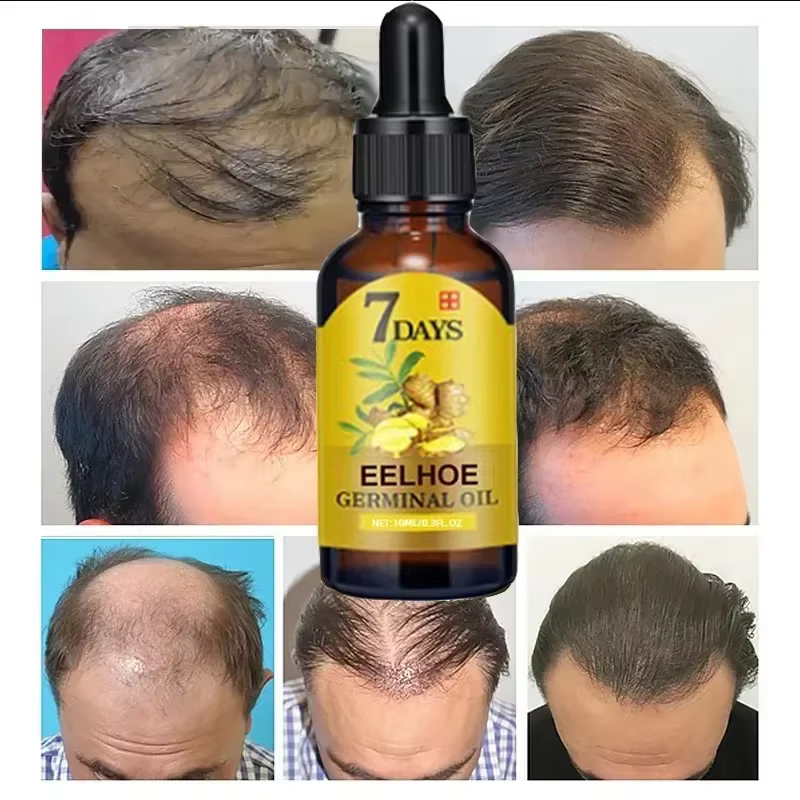 Huile de Croissance Rapide des Cheveux en 7 Jours pour Homme et Femme