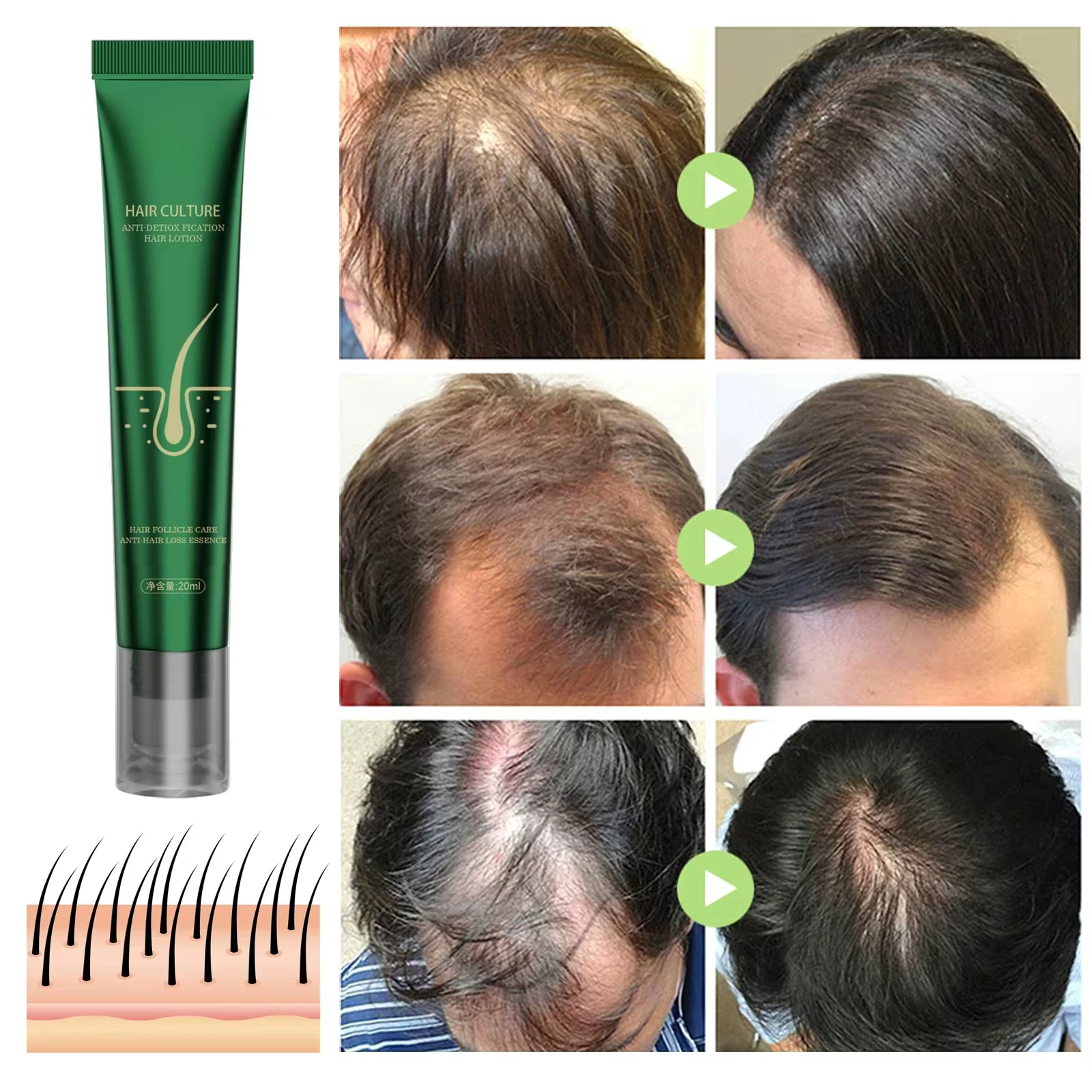Huile essentielle de soin capillaire au gingembre naturel