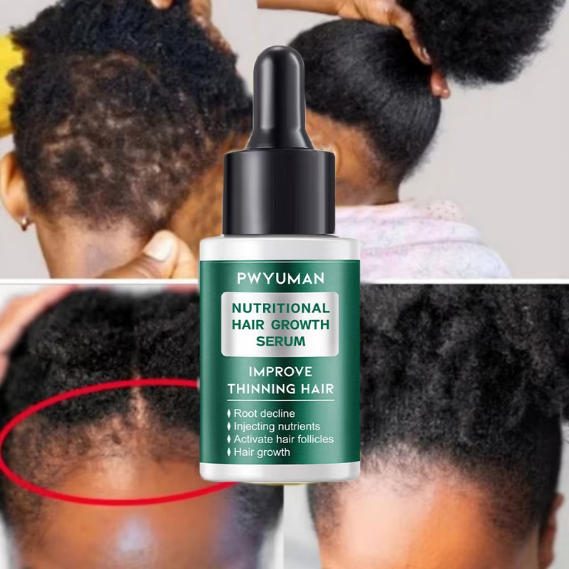 Sérum de croissance rapide des cheveux pour femmes et hommes