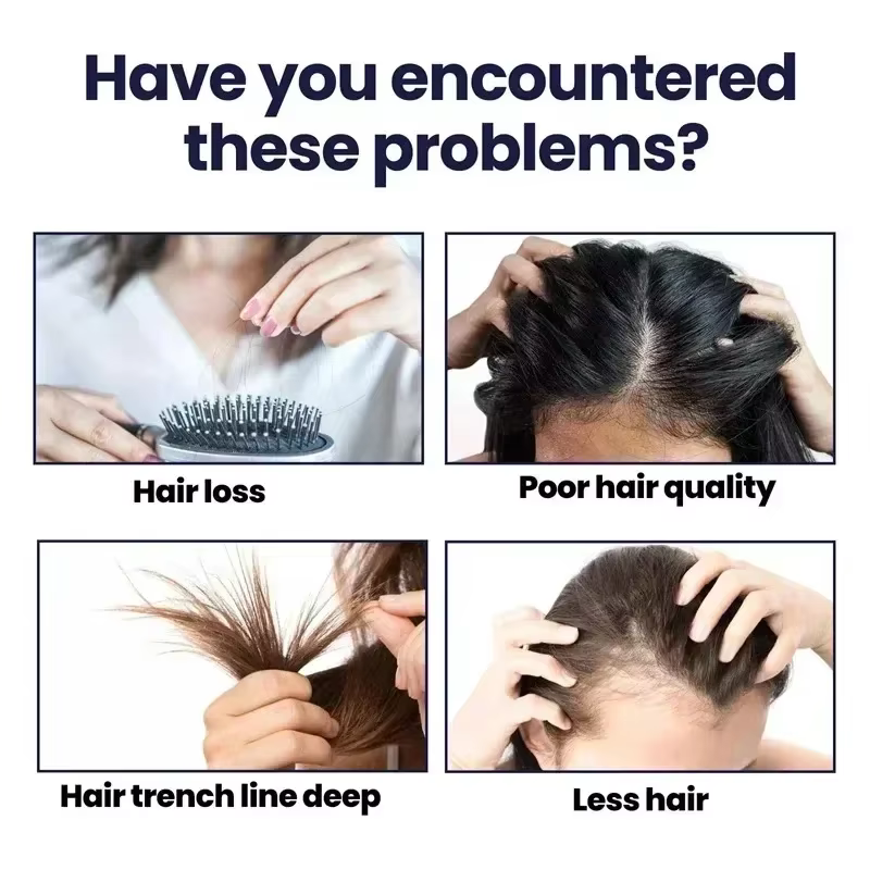 La croissance des cheveux